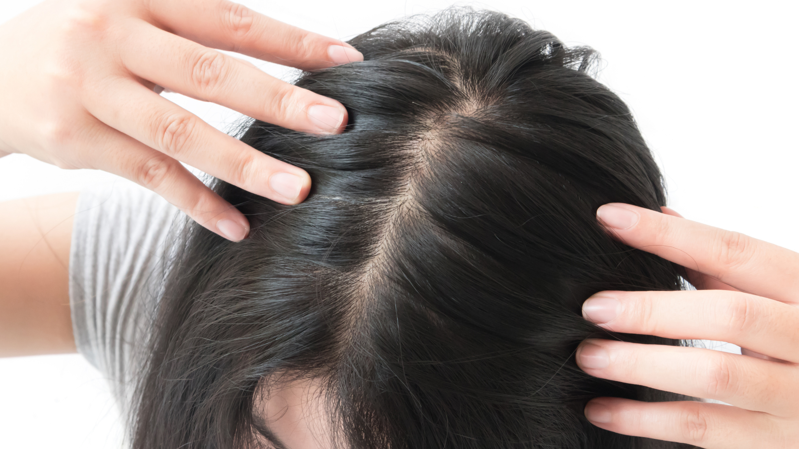Alopecia: Understanding what Hair Loss really is